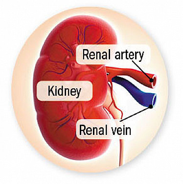 Novel procedure may lower stubbornly high blood pressure featured image