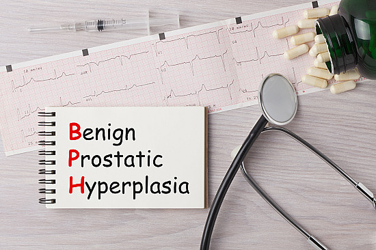 Natural ways to treat an enlarged prostate featured image