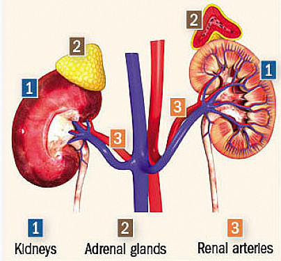 Understanding secondary hypertension featured image